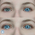 Sweety Koi Blue (1 lens/pack)-Colored Contacts-UNIQSO